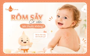 bé bị rôm sảy bôi thuốc gì