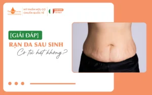 [Giải đáp] Rạn da sau sinh có tự hết không_12