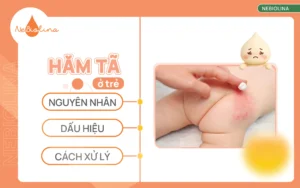 Hăm tã ở trẻ: Nguyên nhân, dấu hiệu và cách xử lý