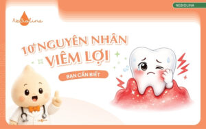 Nguyên nhân viêm lợi