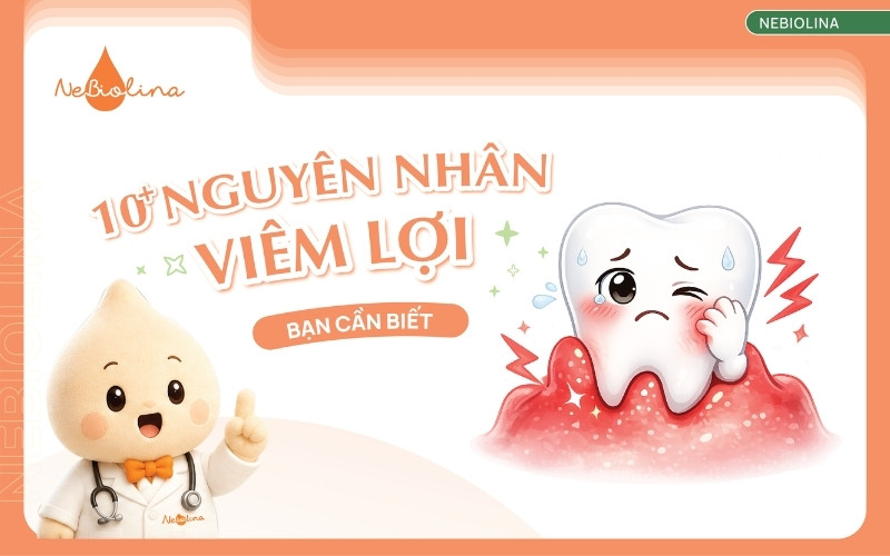 Nguyên nhân viêm lợi