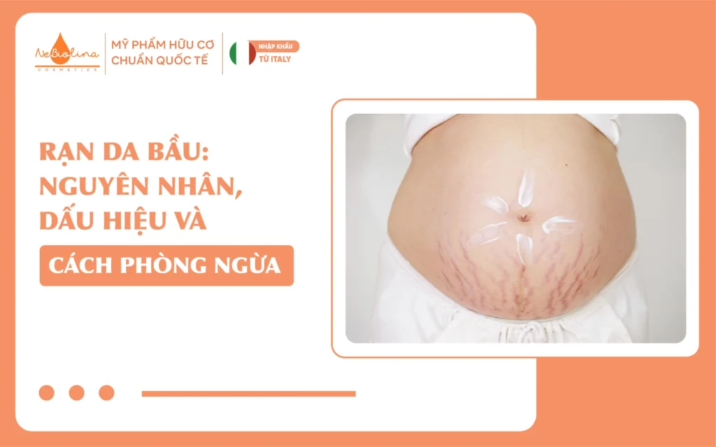 Rạn da bầu Nguyên nhân, dấu hiệu và cách phòng ngừa_14