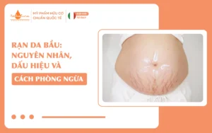 Rạn da bầu Nguyên nhân, dấu hiệu và cách phòng ngừa_14