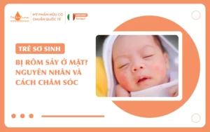 Trẻ sơ sinh bị rôm sảy ở mặt Nguyên nhân và cách chăm sóc_16