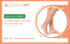 rạn da chân
