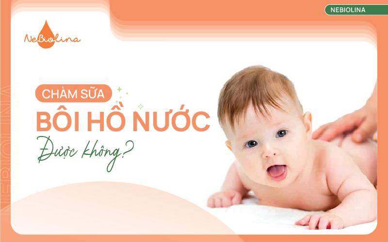 Chàm sữa bôi hồ nước cho bé được không?