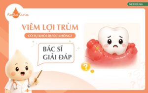 viêm lợi trùm có tự khỏi được không