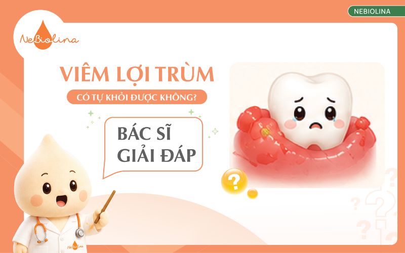 viêm lợi trùm có tự khỏi được không