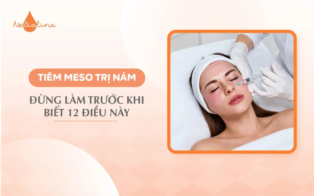 Tiêm meso trị nám: Đừng làm trước khi biết 12 điều này