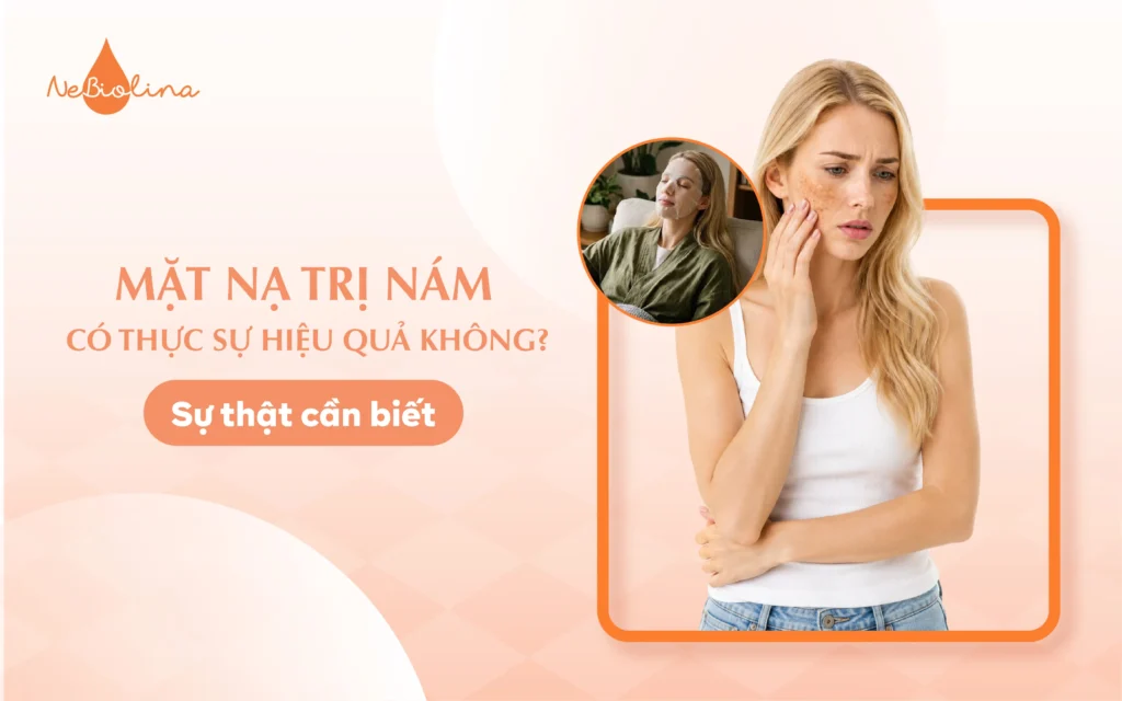 Mặt nạ trị nám có thực sự hiệu quả không? Sự thật cần biết