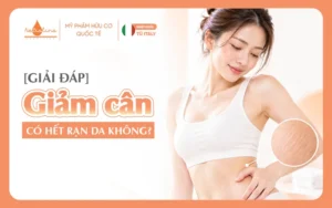 giảm cân có hết rạn da không