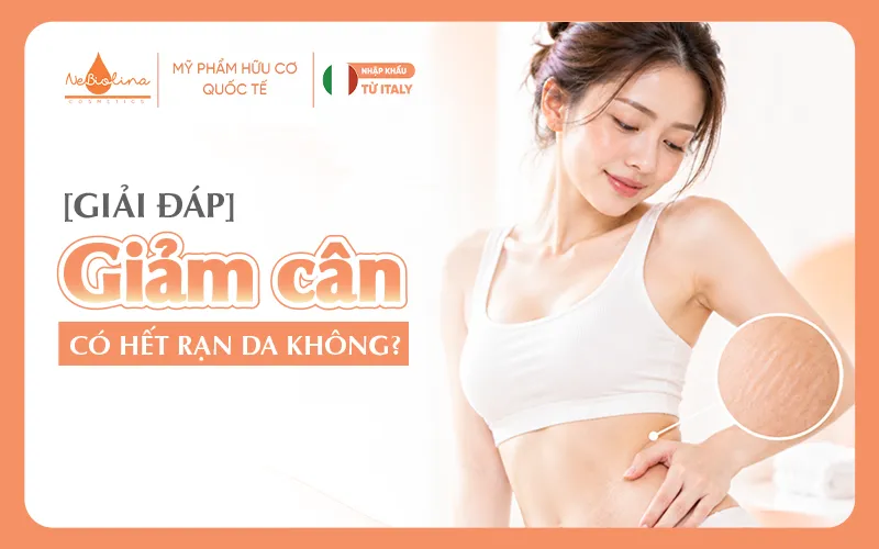 giảm cân có hết rạn da không
